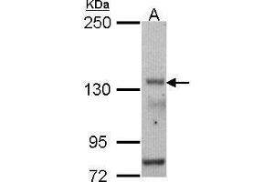 WB Image Sample (30 ug of whole cell lysate) A: HCT116 5% SDS PAGE antibody diluted at 1:500 (POLR3A antibody  (N-Term))
