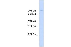 WB Suggested Anti-ZNF224 Antibody Titration: 0. (ZNF224 antibody  (Middle Region))