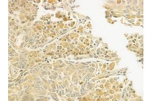 anti-C1q and Tumor Necrosis Factor Related Protein 8 (C1QTNF8) (C-Term) antibody