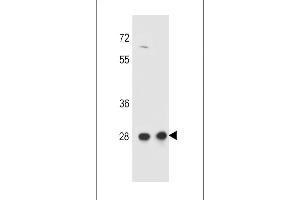 CCDC134 抗体  (C-Term)
