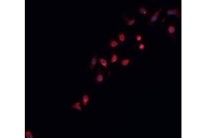 ABIN6266931 staining K-562 cells by IF/ICC. (STEAP3 antibody  (N-Term))