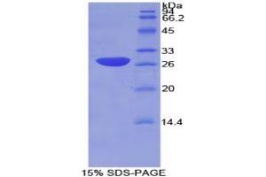SDS-PAGE analysis of Mouse IkBb Protein. (Inhibitory Subunit of NF kappa B beta Protein)