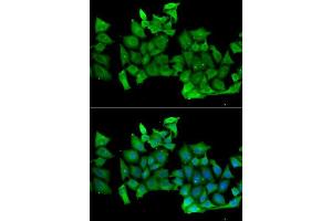 Immunofluorescence analysis of MCF-7 cells using RHOH antibody. (RHOH antibody  (AA 1-191))
