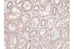 IHC-P analysis of Human Kidney Tissue, with DAB staining. (SYNE2 antibody  (AA 6-296))