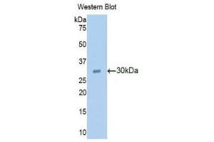Western Blotting (WB) image for anti-Ribonuclease L (2',5'-Oligoisoadenylate Synthetase-Dependent) (RNASEL) (AA 358-583) antibody (ABIN1860458) (RNASEL antibody  (AA 358-583))