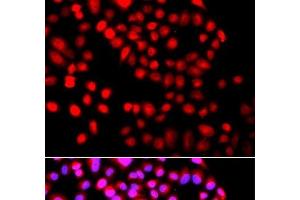 Immunofluorescence analysis of A549 cells using SETD6 Polyclonal Antibody (SETD6 antibody)