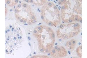 IHC-P analysis of Human Kidney Tissue, with DAB staining. (ADAM9 antibody  (AA 440-680))