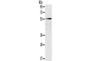Western Blotting (WB) image for anti-Solute Carrier Family 16, Member 10 (Aromatic Amino Acid Transporter) (SLC16A10) antibody (ABIN2427205) (SLC16A10 antibody)