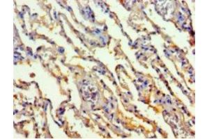 Immunohistochemistry of paraffin-embedded human lung tissue using ABIN7172391 at dilution of 1:100 (TALDO1 antibody  (AA 9-337))