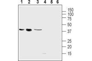 Western blot analysis of mouse muscle myoblast (C2C12), human brain glioblastoma (U-87 MG), human colorectal adenocarcinoma (HT-29) cell lines: - 1-3. (UCP2 antibody  (Intracellular))