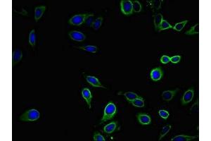 Immunofluorescent analysis of Hela cells using ABIN7151860 at dilution of 1:100 and Alexa Fluor 488-congugated AffiniPure Goat Anti-Rabbit IgG(H+L) (EPH Receptor B2 antibody  (AA 261-465))