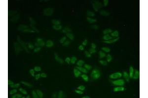 IHC-P analysis of Human HeLa cells, with FITC staining. (BLVRB antibody  (AA 2-206))
