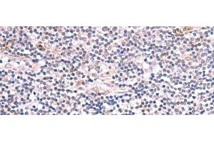 Immunohistochemistry of paraffin-embedded Human tonsil tissue using INPP5K Polyclonal Antibody at dilution of 1:85(x200) (INPP5K antibody)