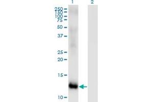 Western Blot analysis of MSRB2 expression in transfected 293T cell line by MSRB2 monoclonal antibody (M01), clone 2B7. (MSRB2 antibody  (AA 102-201))