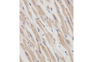 (ABIN6242408 and ABIN6577250) staining RANBP9 in human heart tissue sections by Immunohistochemistry (IHC-P - paraformaldehyde-fixed, paraffin-embedded sections). (Importin 9 antibody  (AA 1-388))
