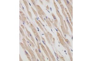 (ABIN6242408 and ABIN6577250) staining RANBP9 in human heart tissue sections by Immunohistochemistry (IHC-P - paraformaldehyde-fixed, paraffin-embedded sections). (Importin 9 antibody  (AA 1-388))