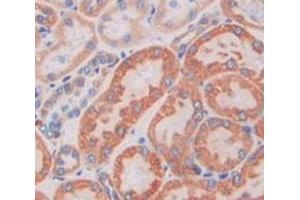 IHC-P analysis of Kidney tissue, with DAB staining. (M6PR antibody  (AA 27-185))
