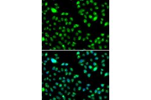 Immunofluorescence analysis of MCF-7 cells using L3MBTL3 antibody (ABIN5974391). (L3MBTL3 antibody)