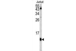 Western Blotting (WB) image for anti-FK506 Binding Protein 1A, 12kDa (FKBP1A) antibody (ABIN3003472) (FKBP1A antibody)