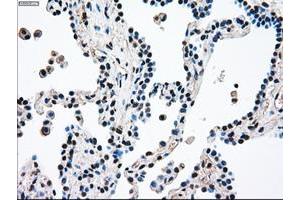 Image no. 1 for anti-Mitogen-Activated Protein Kinase Kinase 4 (MAP2K4) antibody (ABIN1499481) (MAP2K4 antibody)