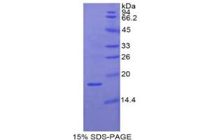 SDS-PAGE analysis of Pig RBP2 Protein.