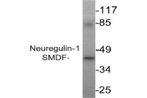 Image no. 2 for anti-Neuregulin 1 (NRG1) antibody (ABIN265466) (Neuregulin 1 antibody)