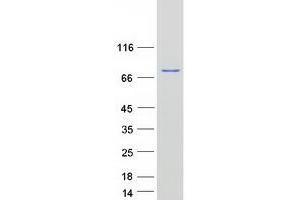 Validation with Western Blot