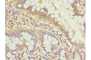 Immunohistochemistry of paraffin-embedded human small intestine tissue using ABIN7163882 at dilution of 1:100 (GALNT3 antibody  (AA 1-140))