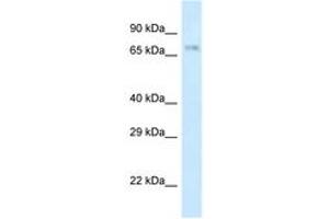 Image no. 1 for anti-Amyloid beta (A4) Precursor Protein-Binding, Family B, Member 2 (APBB2) (AA 63-112) antibody (ABIN6747341) (APBB2 antibody  (AA 63-112))