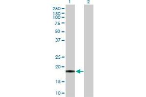 Western Blot analysis of PSCA expression in transfected 293T cell line by PSCA MaxPab polyclonal antibody. (PSCA antibody  (AA 1-123))