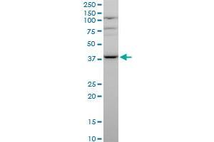 MVK polyclonal antibody (A01), Lot # 051116JC01. (MVK antibody  (AA 297-396))