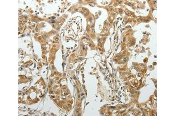 SUN5 antibody  (Internal Region)