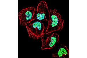 Immunofluorescence (IF) image for anti-Zinc Finger Protein 155 (ZNF155) antibody (ABIN2999111) (ZNF155 antibody)