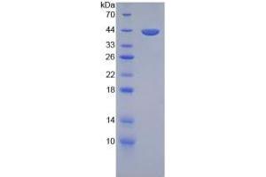 SDS-PAGE of Protein Standard from the Kit (Highly purified E. (Transferrin CLIA Kit)