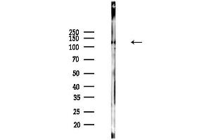 Western blot analysis of lysates from Hela cells(heat-shock,45 min treatment), using Integrin beta3 Antibody at 1/1000 dilution.