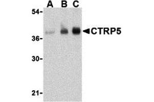 Western Blotting (WB) image for anti-C1q and Tumor Necrosis Factor Related Protein 5 (C1QTNF5) (N-Term) antibody (ABIN1031332) (CTRP5 antibody  (N-Term))