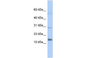 WB Suggested Anti-FAM14A Antibody Titration:  0. (IFI27L2 antibody  (Middle Region))