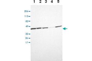 Western blot analysis of Lane 1: RT-4, Lane 2: U-251 MG, Lane 3: A-431, Lane 4: Liver, Lane 5: Tonsil with TMOD3 polyclonal antibody at 1:100-1:250 dilution. (TMOD3 antibody)