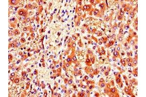 Immunohistochemistry of paraffin-embedded human liver tissue using ABIN7146178 at dilution of 1:100