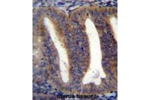 Immunohistochemistry (IHC) image for anti-RNA Binding Protein with Multiple Splicing 2 (RBPMS2) antibody (ABIN2996538) (RBPMS2 antibody)