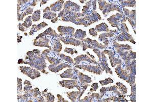 IHC analysis of Aconitase 2 using anti-Aconitase 2 antibody (ABIN7602770). (ACO2 antibody  (C-Term))