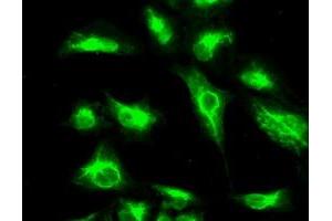 Image no. 3 for anti-Cancer/testis Antigen 1B (CTAG1B) antibody (ABIN1499904) (CTAG1B antibody)