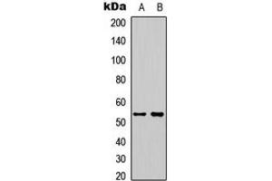 Western blot analysis of STEAP3 expression in HeLa (A), HepG2 (B) whole cell lysates.