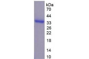 SDS-PAGE analysis of Human AhR Protein.