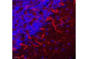 Immunofluorescent analysis of paraformaldehyde-fixed mouse brain using TRIM46 (ABIN7076020) at dilution of 1: 3200 (TRIM46 antibody)