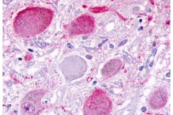 BAI3 antibody  (C-Term)