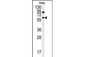 Western blot analysis of anti-ANTXR1 Antibody  (ABIN392154 and ABIN2841879) in Hela cell line lysates (35 μg/lane). (ANTXR1 antibody  (AA 358-386))