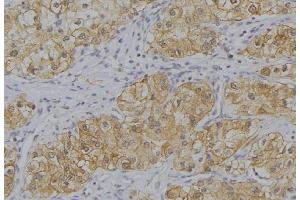 ABIN6273649 at 1/100 staining Human uterus tissue by IHC-P. (IL12B antibody  (C-Term))