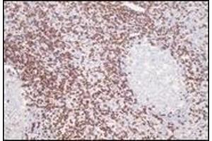Immunohistochemistry (IHC) image for anti-CD8 (CD8) (C-Term) antibody (ABIN870515) (CD8 antibody  (C-Term))