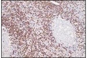 Immunohistochemistry (IHC) image for anti-CD8 (CD8) (C-Term) antibody (ABIN870517) (CD8 antibody  (C-Term))